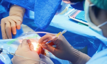 Treatment of a cataract by a surgical method