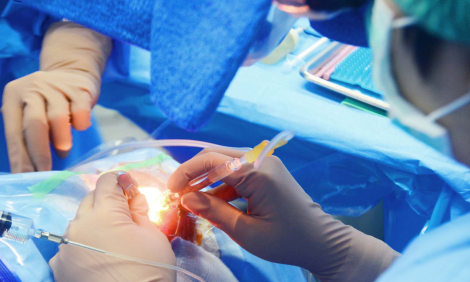 Treatment of a cataract by a surgical method