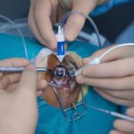 about-retinal-surgery